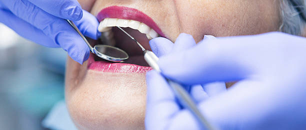 Best Emergency Root Canal Treatment in Drew, MS